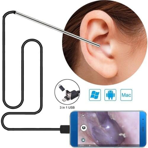 Medical In Ear Cleaning Endoscope Spoon Mini Camera Ears Picker EarWax Removal Mouth Nose HD Visual Otoscope Support Android PC