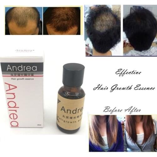 Andrea Hair Growth Ginger Oil Natural Plant Essence Faster Grow Beard Eyelashes Hair Tonic Shampoo Hair Loss Hair Care set