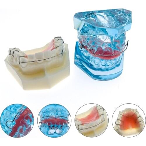Dental Functional Orthopedic Bionator Removable/Hawley Retainer Teeth Model Dental Teach Study Model