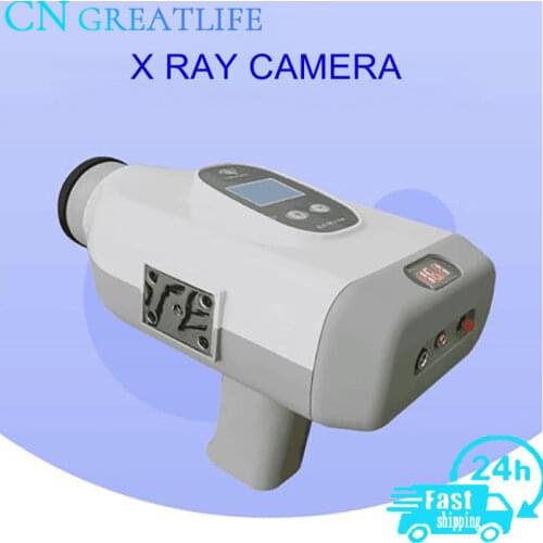 Dental High Frequency X-Ray Unit Digital Portable Dental X Ray Image Unit Machine System Equipment Mobile X Ray Camera