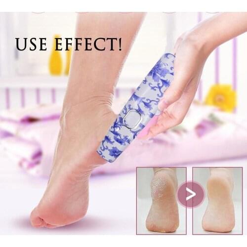 Инструменты для ухода за лицом Moblaser China At AliExpress