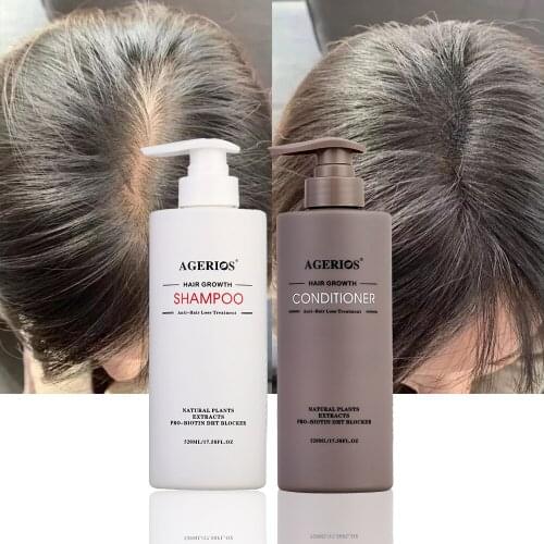 AGerios Free Shipping Organic Hair Regrowth Professional Shampoo And Conditioner Argan Oil For Hair Natural Anti-Hair Loss