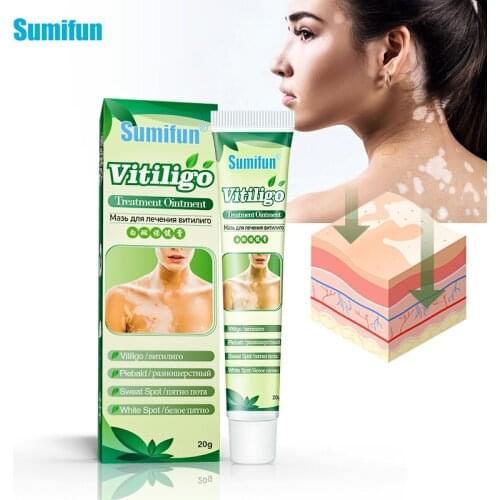 Sumifun 1Pcs Vitiligo Treament Paste Antibacterial Cream Psoriasis Localized Vitiligo Ointment White Spot Mycosis Treatment
