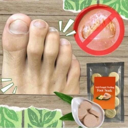 10 Bags Fungal Infections Foot Bath Powder Feet Care Anti-Athletes Foot,Foot Odor,Sweat,Itching,Peeling,Beriberi Treatment