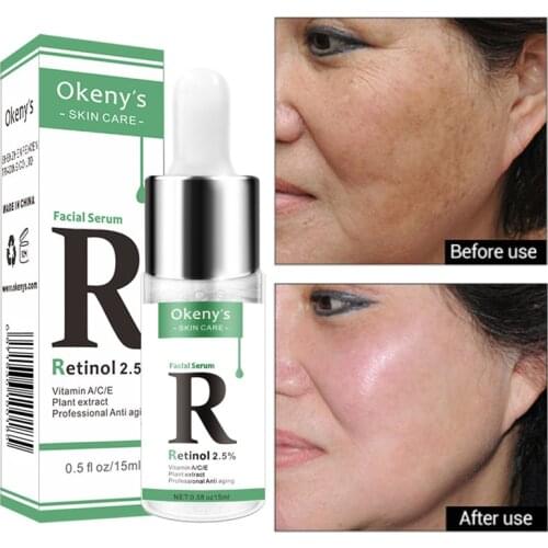 Сыворотки с витамином С для лица ROSOTENA China At AliExpress