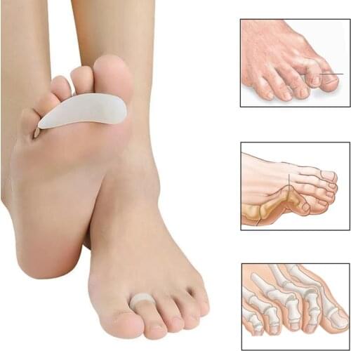 1 Pair Middle Toe Silicone Support Pads For Hammer Toe Correct Separator Metatarsal Ring Orthopedic Straightener Foot Care Tool