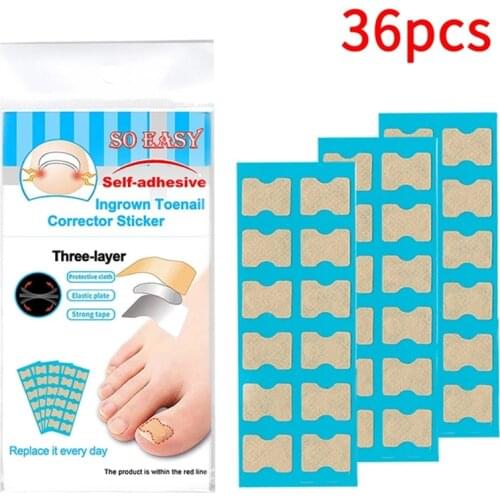 36/72PCS Pedicure Tools Ingrown Toenail Physical Straightening Corrector Elastic Correction Patch Correction Patch Sticker Clip