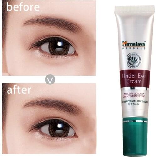 15 ML Indian Natural Pure Plant Himalaya Eye Cream To Reduce Dark Lines And Reduce Fine Lines