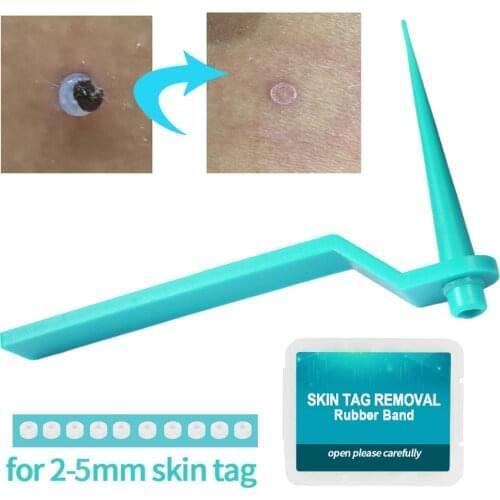 Micro Skin Tag Remover Rubber Bands For Micro Skin Tag Remover Wart Remove Acne Remover Treatments Face Skin Care Repair Tool