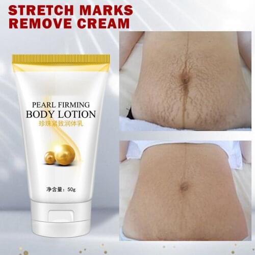 Yoxier Pearl Firming Body Lotion Slimming Cellulite Massage Remove Stretch Marks Cream Treatment Body Skin Care Health Lift Tool