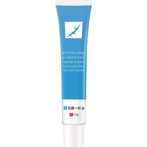 Scar Removal Cream Face Cream For Face Acne Scar Stretch Cream Cream Face Acne Repair Skin Marks Remover Spots R3N3