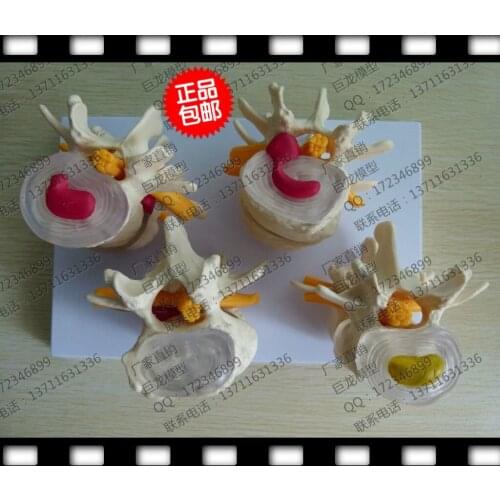 Spine model Human model Spine lumbar combination model of human skeleton model