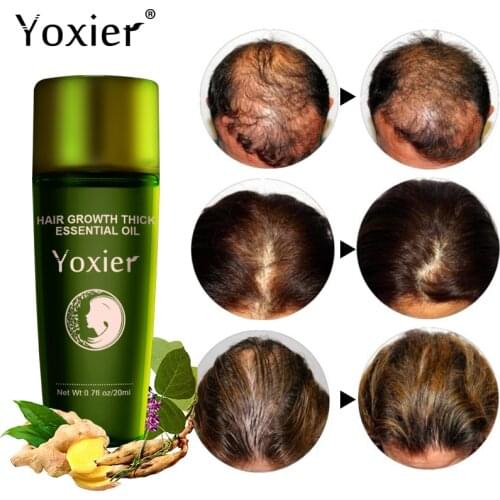 Yoxier Herbal Hair Growth Essential Oil Shampoo Hair Care Styling Hair Loss Product Thick Fast Repair Growing Treatment Liquid