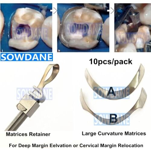 Dental Tofflemire Matrix for Deep Margin Elevation Large Curvature Matrices Retainer Sectional Contoured Matrice Dental Material