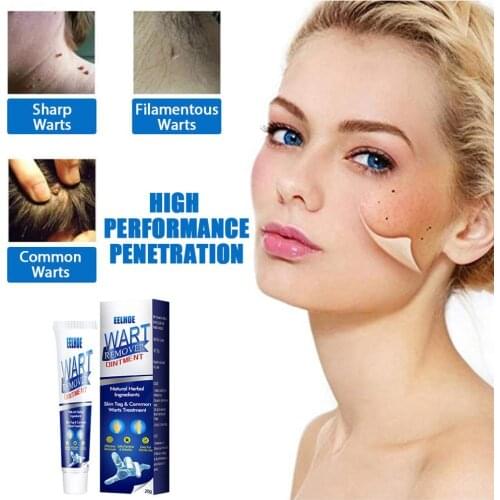 Instant Blemish Removal Gel Whitening Anti Warts Cream Effectively Remove the Warts Pigmented Melanin Spots Skin Care