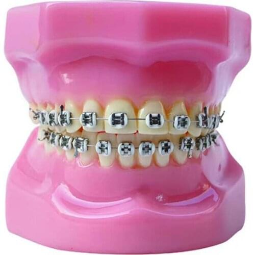 Dental Orthodontic Model with Metal and Ceramic Brackets Dental Teeth Study Model Clear Tooth Model