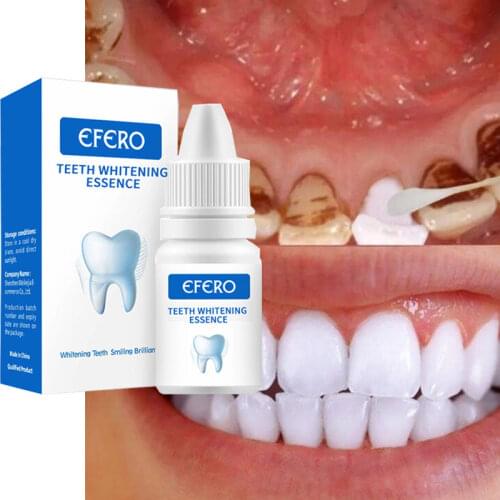 GEONYIEEK Teeth Whitening Gels