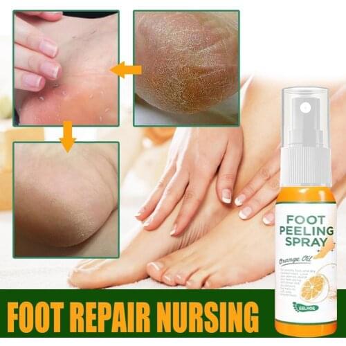 Foot Exfoliating Spray To Remove Dead Skin On Feet Elbows And Knees To Remove Calluses And Crusty Foot Care