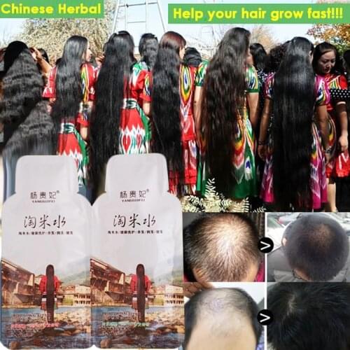 Rice Hair Growth Shampoo Anti Hair Loss Treatment Essence Fast Growth Longer thicker Hair for Men Women Best Hair Care Product