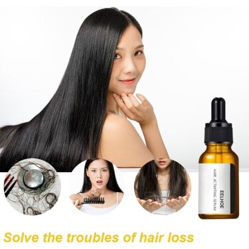 Eelhoe 20ml Fast Hair Growth Anti-hair Loss Fluid Repairs Damaged Hair Activating Serum Natural Hair Care No stimulation TSLM2