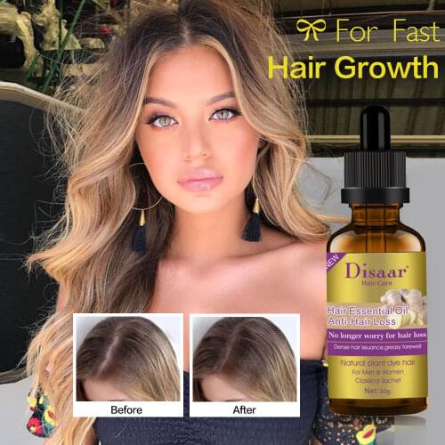 Fast Growth Hair Essence Anti Hair Loss Treatment Hair Care Products Nourish Hair Root and Scalp Nutrient Solution 30ml