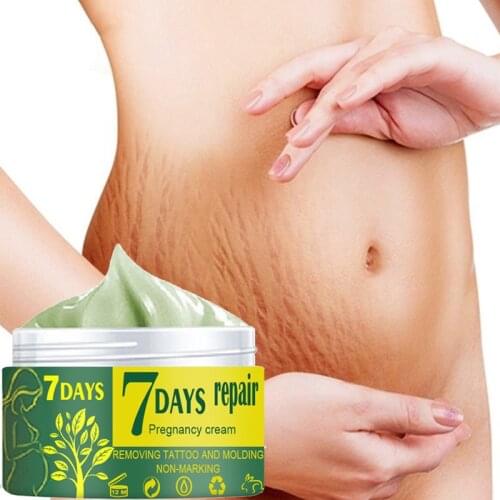 7 Days Stretch Mark Repair Cream Postpartum Repairing Pregnancy Body Marks Removal Scar Moisturizing Skin Care Cream 10/30/50g