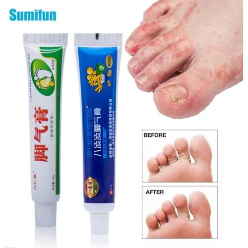 Two Styles Anti Fungal Infections Foot Cream For Athletes Foot Pain Relief Beriberi Itch Erosion Peeling Blisters Feet Ointment