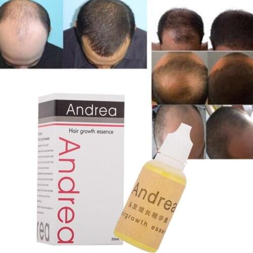 20ml Hair Growth Oil Thickener for Hair Growth Serum Hair Loss Product 100% Natural Plant Extract Liquid