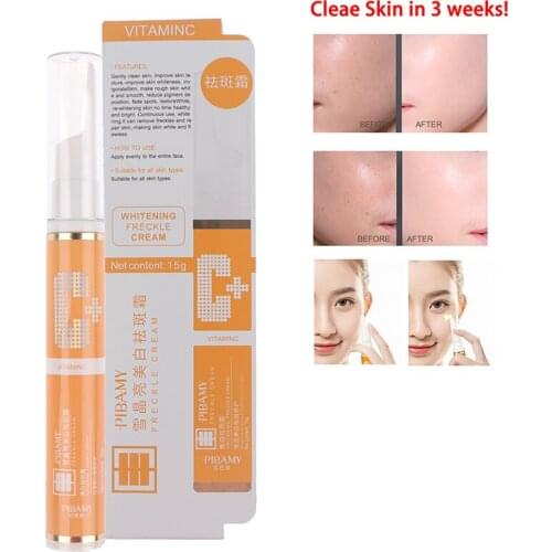 Instant Blemish Removal Gel Vitamin C Whitening Anti Freckle Cream Pen Effectively Remove the Freckle Pigmented Melanin Spots