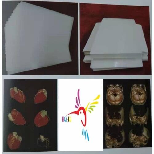 125 Microns White Inkjet Medical Film Inkjet White Film for EPSON CANON HP and All Kinds of Inkjet Printer
