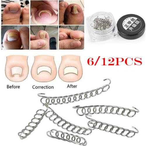6 12pcs/set Ingrown Toe Nail Correction Wire Fixer Pedicure Paronychia Recover Toenails Corrector Fixer Pedicure Foot Care Tool