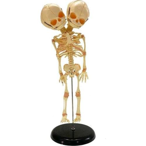 Double head Fetal skeleton model Medical teaching and explanation of human body structureTeaching aids