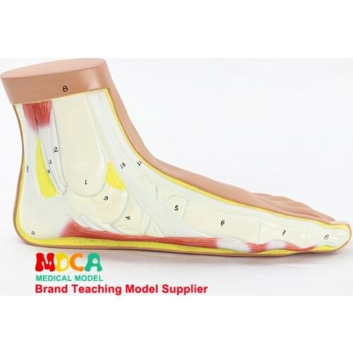 Flat foot, flat foot arch collapse model joint anatomy model medical teaching MJRJ003