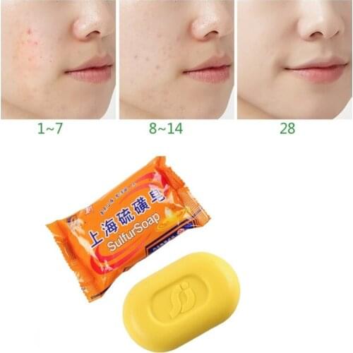Shanghai Sulfur Soap Whitening Oil Control Acne Treatment Blackhead Remover Soap Body Soap Skin Care T1205