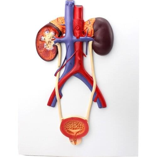 Human Anatomy Bladder Catheterization Renal Urinary System Model Kidney Arteriovenous Model Medical Teaching