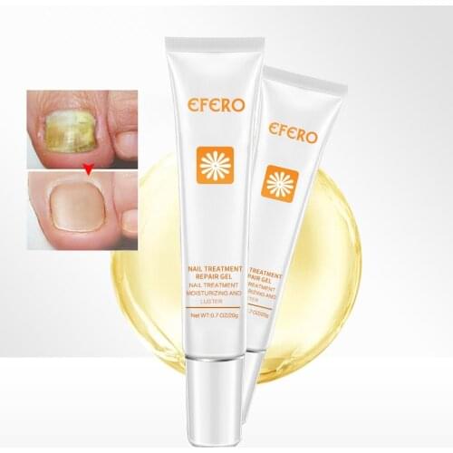 EFERO Nail Fungus Treatment Onychomycosis Paronychia Anti Fungal Toe Nail Fungus Removal Gel Herb Nails Care Repair Essence