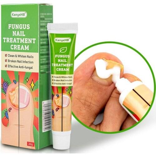 1pcs Nail Fungus Treatment Cream Removal Nail Paronychia Onychomycosis Ointment Feet Whitening Toe Care Plaster