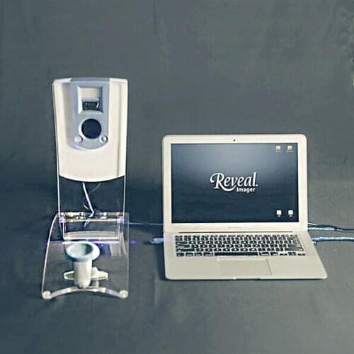 Girlove Skin Analyzers