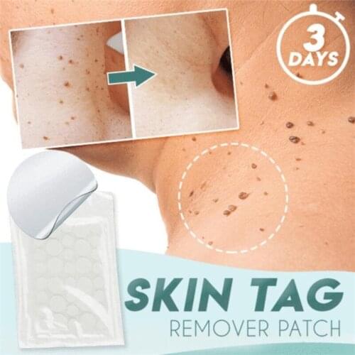 24/36/72pcs Skin Tag Remover Warts Remover Patch Wart Treatment Cream Herbal Extract Foot Corn Plaster Acne Warts Ointment