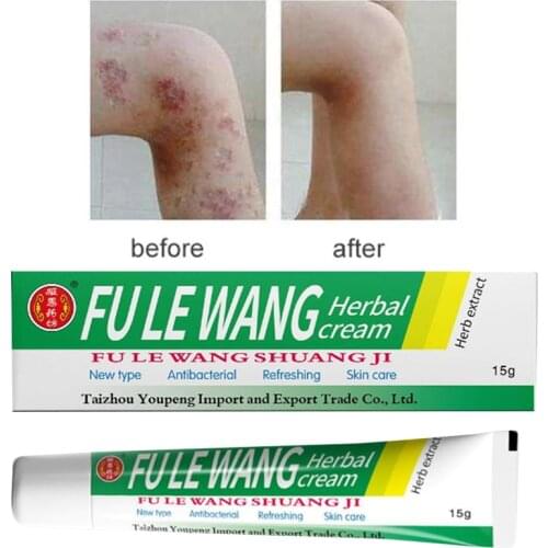 FU LE WANG Skin Antibacterial Herbal Cream Dermatitis Eczematoid Eczema Ointment Treatment Psoriasis Cream 15g