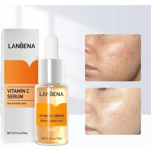 LANBENA Vitamin C Whitening Face Serum Remove Spot Freckle Active Brighten Anti Aging Improve Dullness Moisturizing Skin Care