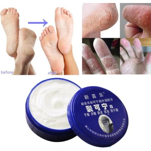 Traditional Chinese Oil Anti-Drying Crack Foot Cream Heel Cracked Repair Cream Removal Dead Skin Hand Feet Care Ointment 33g