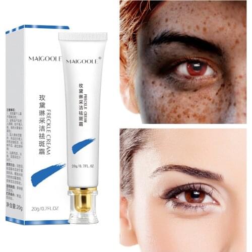 Powerful Whitening Freckle Cream Remove Melasma Acne Spot Pigment Melanin Dark Spots Pigmentation Moisturizing Gel Skin Care