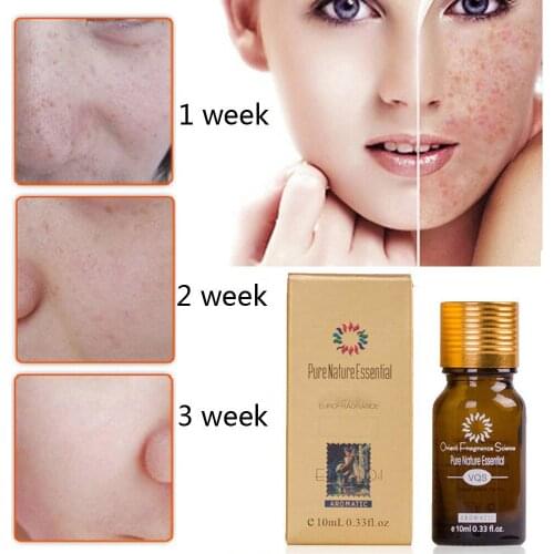 Natural Ultra Brightening Spotless Oil Skin Care Age Dark Spots Remove Ance Burn Strentch Marks Scar Removal Whitening Essence