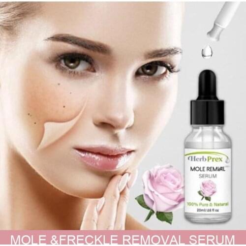 30ml Herb Perx Organic Mole Remover Remove Mole Cream Light Spot Mole Lotion Remover Spot Mole Water Point Remove Black Artifact