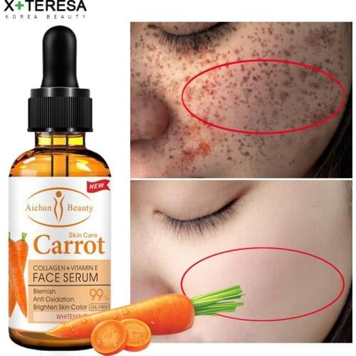Dark Spot Corrector Whitening Serum Face Bleaching Serum Brighten Blemish Freckle Remover Natural Carrot Essence Korea Skin Care