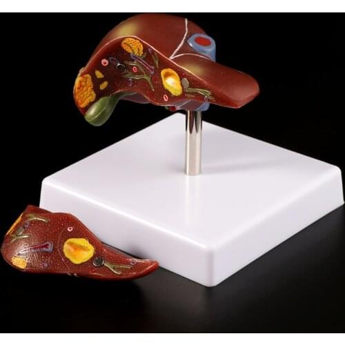 Human Liver Pathological Anatomical Model Anatomy School Medical Teaching Display Tool Lab Equipment