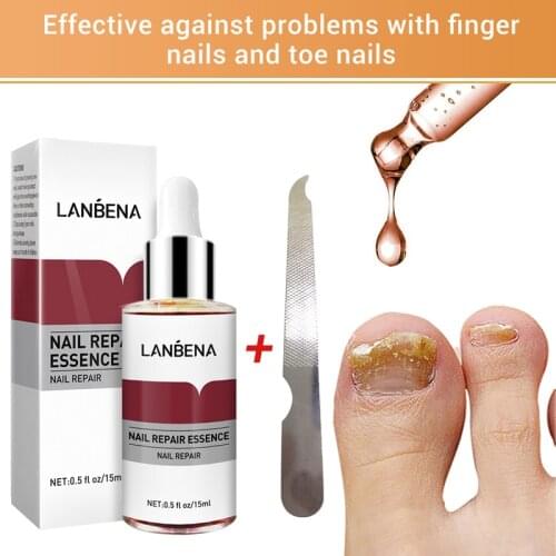 LANBENA Curing Nail Fungus Treatment Essence Oil 15 ml Antifungal Nail Killer Toe Finger Fungus Removal Feet Care Onychomycosis