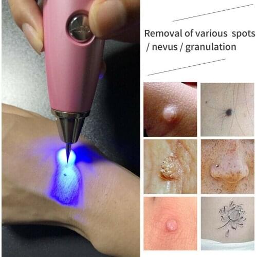 Laser Plasma Pen Skin Care Dark Spot Mole Remover Facial Freckle Mole Tattoo Removal Machine Tag Wart Removal Pen