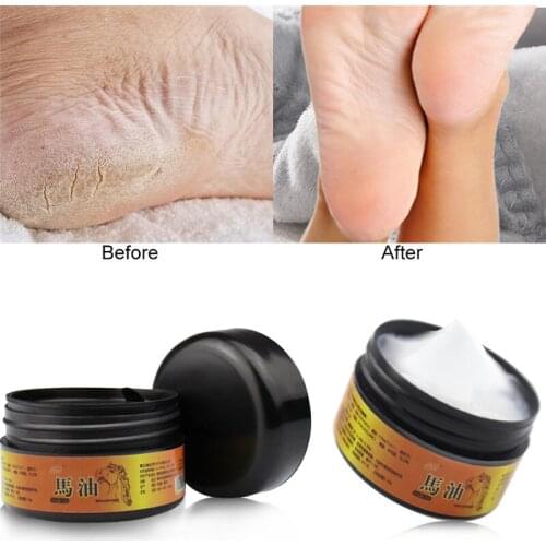 Horse oil hand cream and foot cream repair anti-aging winter anti-cracking film heel cream foot exfoliating foot cream